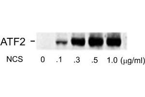 Western blots of human melanoma cells incubated with varying doses of the radiomimetic drug NCS showing specific immuno-labeling of the ~74k ATF2 protein phosphorylated at Ser490 and Ser498. (ATF2 antibody  (pSer490, pSer498))