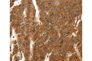 Immunohistochemistry (IHC) image for anti-Sodium Channel, Voltage-Gated, Type XI, alpha Subunit (SCN11A) antibody (ABIN2432261)