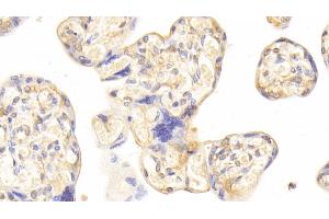 Detection of CDO1 in Human Placenta Tissue using Polyclonal Antibody to Cysteine Dioxygenase I (CDO1) (CDO1 antibody  (AA 1-200))
