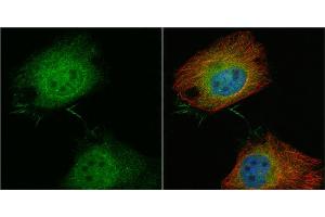 ICC/IF Image T-Plastin antibody detects T-Plastin protein at cytoplasm and nucleus by immunofluorescent analysis. (Plastin 3 antibody)