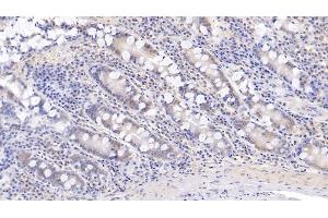 Detection of IL17 in Human Small intestine Tissue using Monoclonal Antibody to Interleukin 17 (IL17) (IL-17 antibody  (AA 20-155))