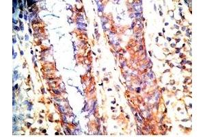 Human colon tissue was stained by Rabbit Anti-GLP-1 (2-24) (Human) Antibody (GLP-1 antibody  (AA 2-24))
