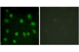 Immunofluorescence analysis of HuvEc cells, using Dematin (Ab-403) Antibody. (Dematin antibody  (AA 356-405))
