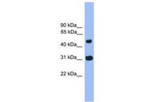 Image no. 1 for anti-Family with Sequence Similarity 13, Member C (FAM13C) (AA 81-130) antibody (ABIN6745285) (FAM13C antibody  (AA 81-130))