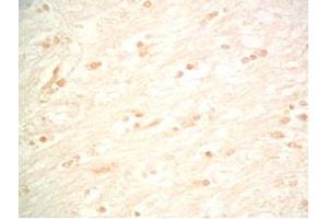Rat brain tissue was stained by Rabbit Anti-Metasin (1-25) / KISS-1 (68-92) (Human) Serum (KISS1 antibody  (AA 1-25, AA 68-92))