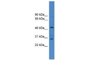 WB Suggested Anti-ARMC8 Antibody Titration: 0. (ARMC8 antibody  (N-Term))