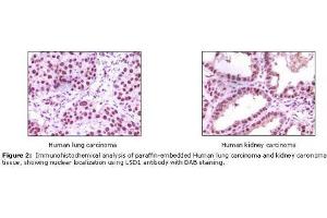 Image no. 1 for anti-Lysine (K)-Specific Demethylase 1A (KDM1A) antibody (ABIN207611) (LSD1 antibody)