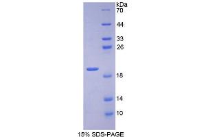Image no. 1 for Inositol Polyphosphate-4-Phosphatase, Type I, 107kDa (INPP4A) (AA 1-137) protein (His tag) (ABIN4990941)
