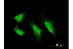 Immunofluorescence of monoclonal antibody to PRKCI on HeLa cell. (PKC iota antibody  (AA 1-587))