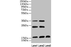 Western Blot All lanes: SFT2D2 antibody at 8 μg/mL Lane 1: Mouse liver tissue Lane 2: Mouse kidney tissue Lane 3: Mouse thymus tissue Secondary Goat polyclonal to rabbit IgG at 1/10000 dilution Predicted band size: 18 kDa Observed band size: 18, 26, 36 kDa (SFT2D2 antibody  (AA 1-36))
