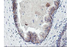 Image no. 3 for anti-Dystrobrevin, beta (DTNB) antibody (ABIN1497913) (Dystrobrevin beta antibody)