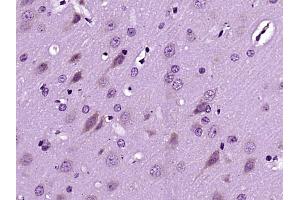 Paraformaldehyde-fixed, paraffin embedded Rat brain; Antigen retrieval by boiling in sodium citrate buffer (pH6. (DSCAM antibody  (AA 301-400))