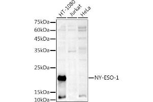 Western blot analysis of extracts of various cell lines, using NY-ESO-1 antibody (ABIN6129965, ABIN6139172, ABIN6139173 and ABIN6225112) at 1:1000 dilution. (CTAG1B antibody  (AA 1-180))