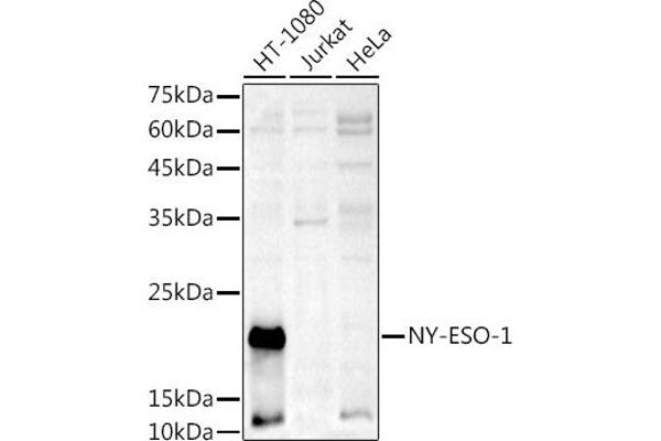 CTAG1B antibody  (AA 1-180)