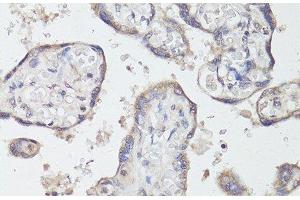 Immunohistochemistry of paraffin-embedded Human placenta using TrkB Polyclonal Antibody at dilution of 1:200 (40x lens). (TRKB antibody)