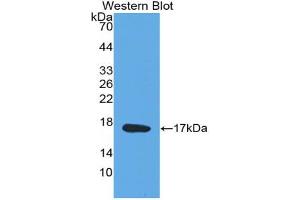 Western blot analysis of the recombinant protein. (Midkine antibody  (AA 22-143))