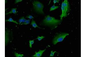 Immunofluorescence staining of U251 cells with ABIN7151082 at 1:133, counter-stained with DAPI. (NEURL1B antibody  (AA 1-275))