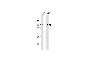 All lanes : Anti-PRK Antibody at 1:1000 dilution Lane 1: 293 whole cell lysate Lane 2: Hela whole cell lysate Lysates/proteins at 20 μg per lane. (PRKAA2 antibody)