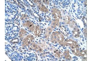 FBP1 antibody was used for immunohistochemistry at a concentration of 4-8 ug/ml. (FBP1 antibody  (N-Term))