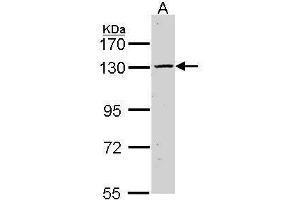 WB Image Sample (30 ug of whole cell lysate) A: Hela 7. (CASR antibody)