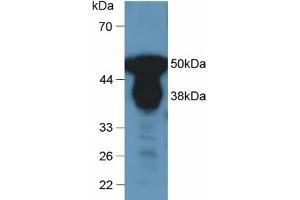 Western blot analysis of Human Urine. (Pepsin antibody)