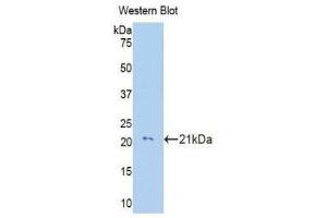 Western Blotting (WB) image for anti-Collagen, Type VIII, alpha 2 (COL8A2) (AA 533-698) antibody (ABIN1176005) (COL8a2 antibody  (AA 533-698))
