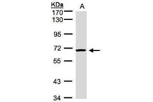 WB Image Sample(30 μg of whole cell lysate) A:Hep G2, 7. (ACVRL1 antibody  (Internal Region))
