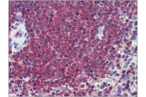Human Spleen: Formalin-Fixed, Paraffin-Embedded (FFPE) (CA1 antibody  (Internal Region))