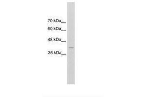 Image no. 1 for anti-Renin (REN) (C-Term) antibody (ABIN203366) (Renin antibody  (C-Term))