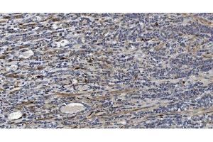 IHC analysis of Alpha B Crystallin/CRYAB using anti-Alpha B Crystallin/CRYAB antibody (ABIN7601209). (CRYAB antibody  (AA 30-151))