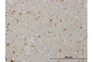 Immunoperoxidase of monoclonal antibody to SMG1 on formalin-fixed paraffin-embedded human adrenal gland. (SMG1 antibody  (AA 2922-3031))
