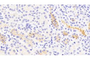 Detection of Kim1 in Human Kidney Tissue using Polyclonal Antibody to Kidney Injury Molecule 1 (Kim1) (HAVCR1 antibody  (AA 21-240))