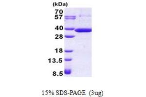 SDS-PAGE (SDS) image for Retinoic Acid Receptor Responder (Tazarotene Induced) 1 (RARRES1) (AA 43-294) protein (His tag) (ABIN5853032) (RARRES1 Protein (AA 43-294) (His tag))