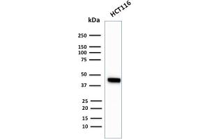 Western Blotting (WB) image for anti-Keratin 18 (KRT18) antibody (ABIN6939939)