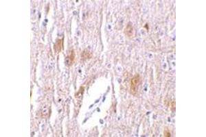 Immunohistochemistry of TRIM5 delta in mouse brain tissue with this product at 1 μg/ml. (TRIM5 antibody  (C-Term, Isoform delta))