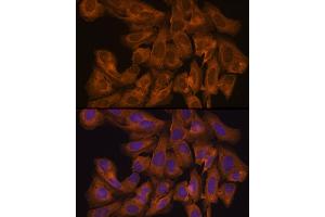 Immunofluorescence analysis of U-2 OS cells using J Rabbit pAb (ABIN7268038) at dilution of 1:100 (40x lens). (JAK1 antibody  (AA 120-380))
