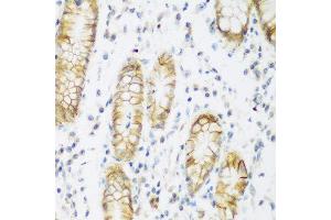 Immunohistochemistry of paraffin-embedded human stomach using KIAA1456 antibody at dilution of 1:200 (40x lens). (KIAA1456 antibody)