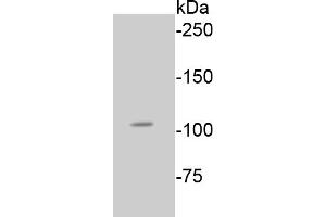 Lane 1: A549 lysates probed with Rb(S807) (2D10) Monoclonal Antibody  at 1:1000 overnight at 4˚C. (Retinoblastoma 1 antibody  (pSer807))