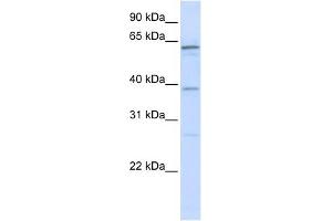 RBM39 antibody used at 1 ug/ml to detect target protein. (RBM39 antibody  (N-Term))