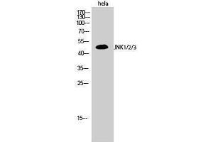 Western Blotting (WB) image for anti-Mitogen-Activated Protein Kinase 8 (MAPK8) (Lys278) antibody (ABIN3185270) (JNK antibody  (Lys278))