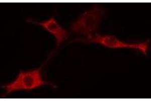 ABIN6275358 staining 293 cells by IF/ICC. (PIGX antibody  (Internal Region))