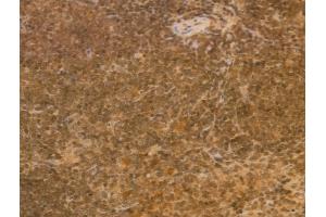 ABIN6257590 and ABIN6274935 at 1/100 staining Mouse spleen tissue by IHC-P. (CHP antibody  (Internal Region))