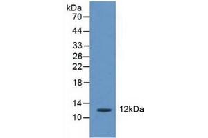Western blot analysis of Human Liver Tissue. (CRADD antibody  (AA 1-199))