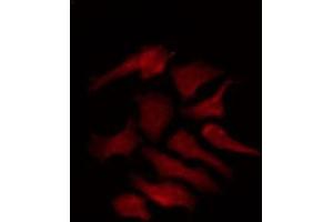Immunofluorescence (fixed cells) (IF/ICC) image for anti-Potassium Voltage-Gated Channel, Delayed-Rectifier, Subfamily S, Member 2 (KCNS2) (Internal Region) antibody (ABIN6258867)