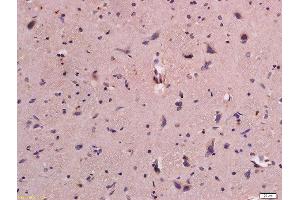 Immunohistochemistry (Paraffin-embedded Sections) (IHC (p)) image for anti-Platelet/endothelial Cell Adhesion Molecule (PECAM1) (AA 601-680) antibody (ABIN669006)