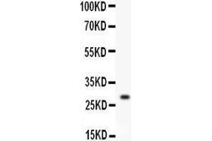 Western Blotting (WB) image for anti-Kallikrein 1 (KLK1) (AA 25-261) antibody (ABIN3042937)