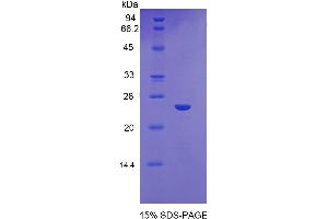 SDS-PAGE analysis of Mouse Glutathione synthetase Protein.