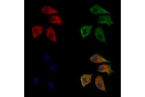 ABIN6266012 and ABIN6272461 staining Hela cells by IF/ICC. (WASF1 antibody  (Internal Region))