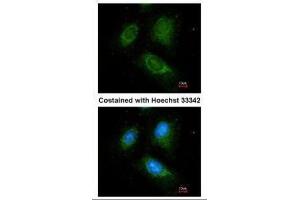 ICC/IF Image Immunofluorescence analysis of methanol-fixed HeLa, using ACADM, antibody at 1:100 dilution. (Medium-Chain Specific Acyl-CoA Dehydrogenase, Mitochondrial (N-Term) antibody)