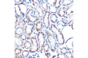 Immunohistochemistry of paraffin-embedded mouse kidney using Lumican (LUM) (LUM) Rabbit mAb (ABIN7268309) at dilution of 1:100 (40x lens). (LUM antibody)